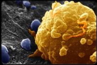 سلول سرطانی1